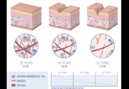 都在問(wèn)的乙酰殼糖胺（NAG）功效怎么樣？功效成分的護(hù)膚品應(yīng)該怎么選？