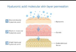 如何選擇適合油痘肌的精華產(chǎn)品？